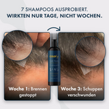 Cold Hug™ Calm Roots 100ml – Miniatur 3