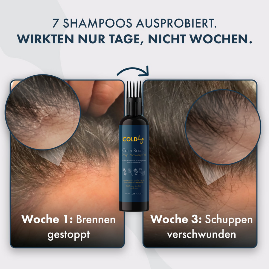 Cold Hug™ Calm Roots 100ml – Bild 3