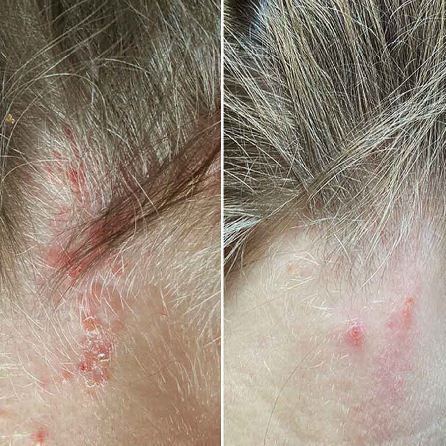 Cold Hug™ Calm Roots 100ml – Bild 3