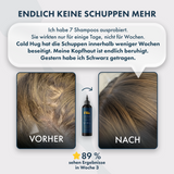 Cold Hug™ Calm Roots 100ml – Miniatur 5