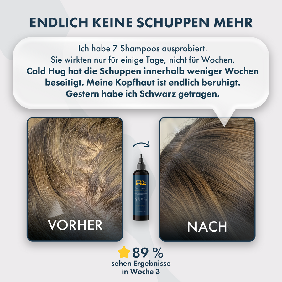 Cold Hug™ Calm Roots 100ml – Bild 5