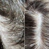 Cold Hug™ Calm Roots 100ml – Miniatur 2