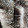 Cold Hug™ Calm Roots 100ml