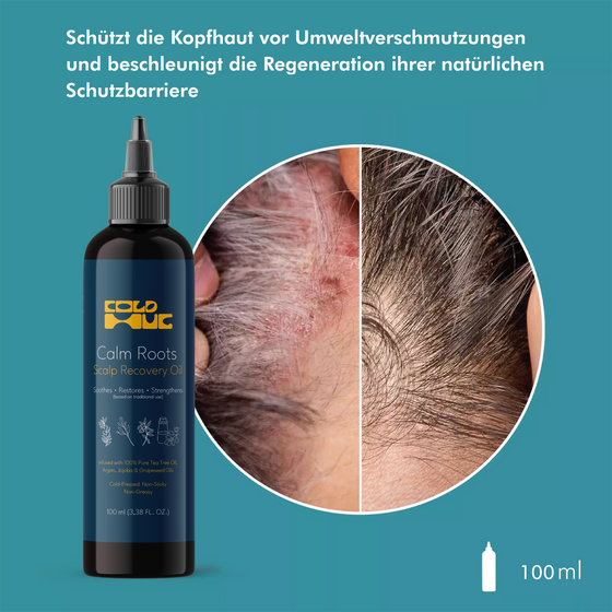 Cold Hug™ Calm Roots 100ml
